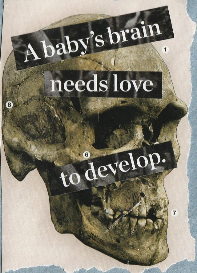 A baby's brain needs love to develop