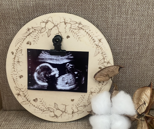 Carte échographie en bois - Cadre photo echographie