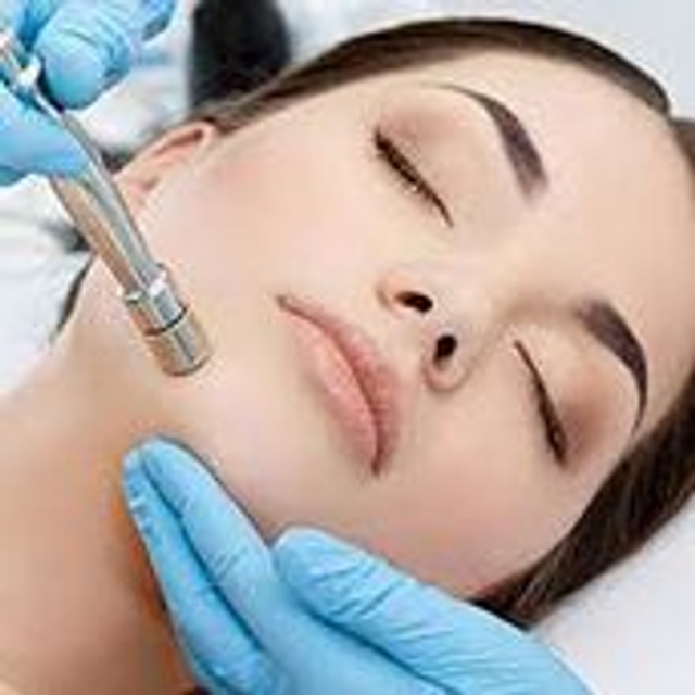 Facial - Microdermabrasion