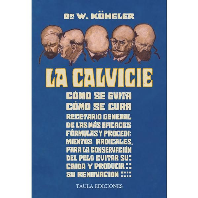 LA CALVICIE: CÓMO SE EVITA, CÓMO SE CURA.