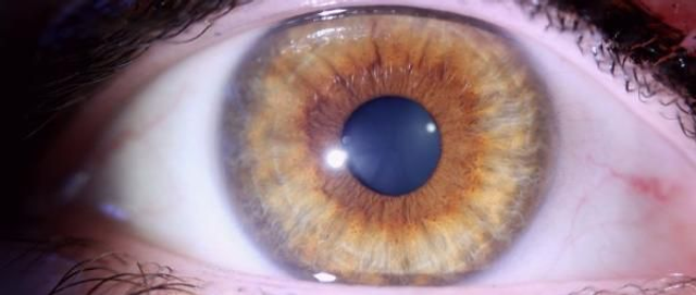 Consultation en iridologie - Aix en Provence