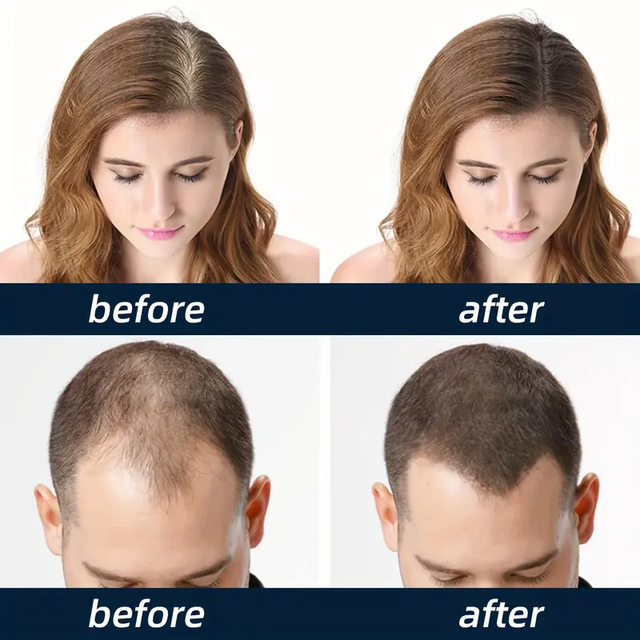 Hair Spray, 5pcs Hair Care Spray