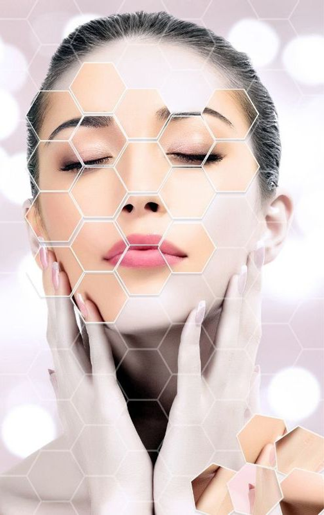 Nasolabial Folds Fillers 