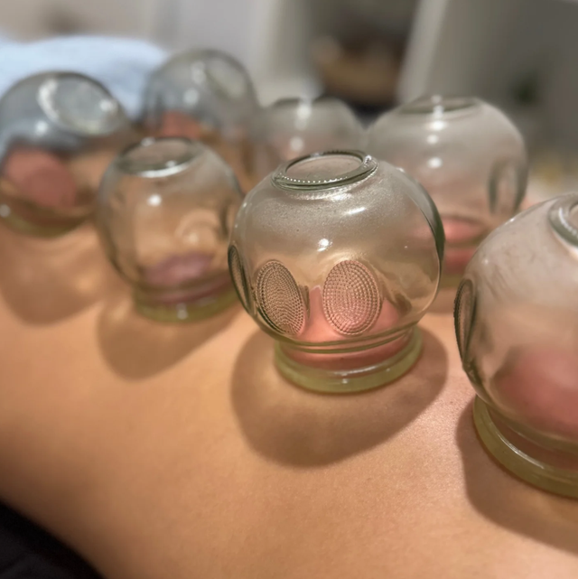 Ventouses thérapie 1H
