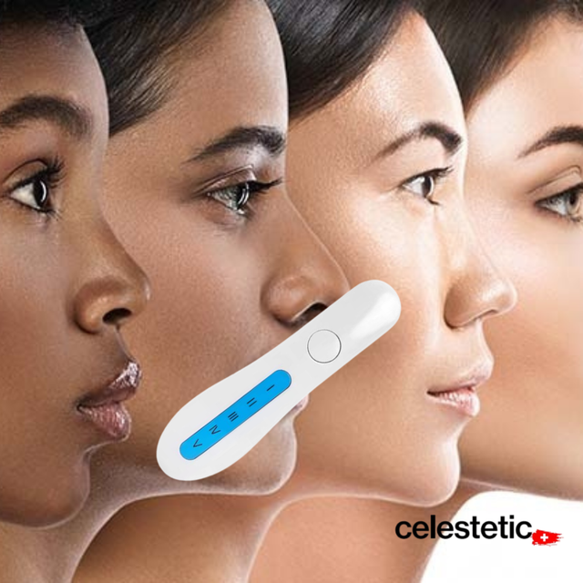 ANALYSEUR DE PHOTOTYPE