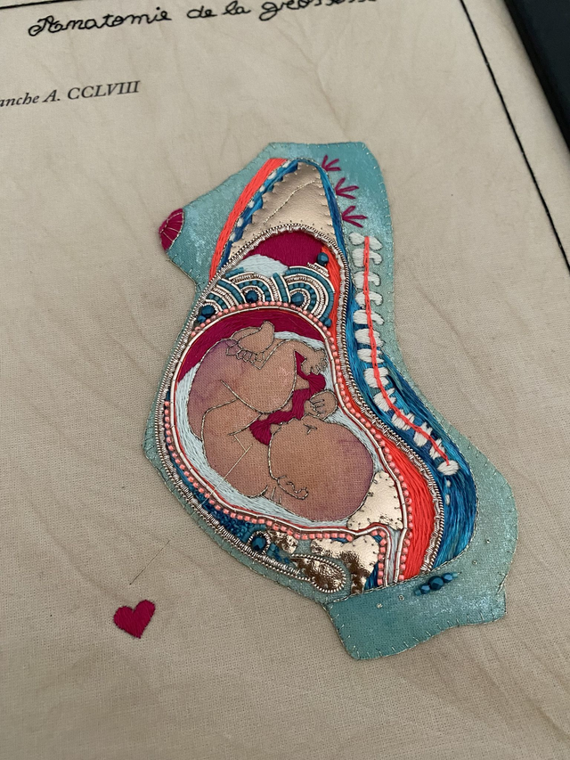 Planche anatomique grossesse bleu et rose fluo