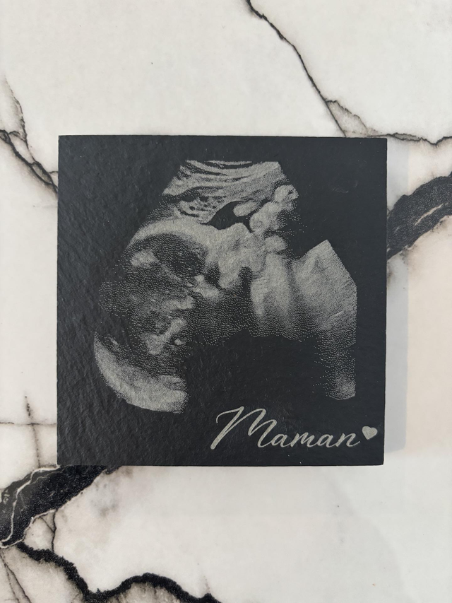Echographie gravé sur un dessous de verre en ardoise 10 x 10 cm pour maman