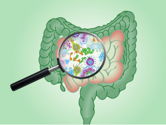 Test de SIBO (Sobrecrecimiento bacteriano en el intestino delgado)