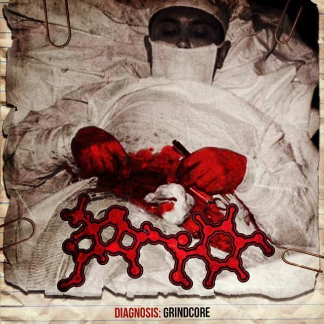 CD - Amoclen - Diagnosis: Grindcore (Jewel Case)