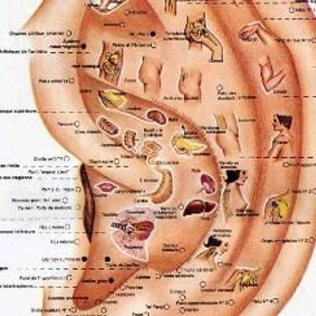 Auriculothérapie