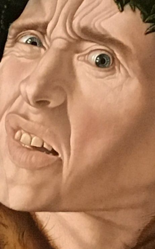 Cefaleas por tension (1 vial)