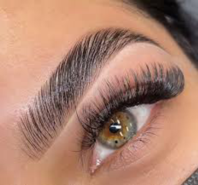 Brow lift 