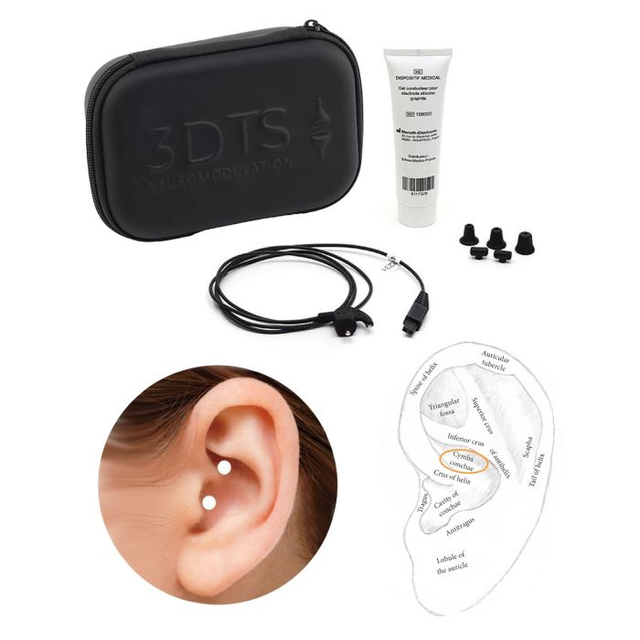 Kit nerf vague 3DTS