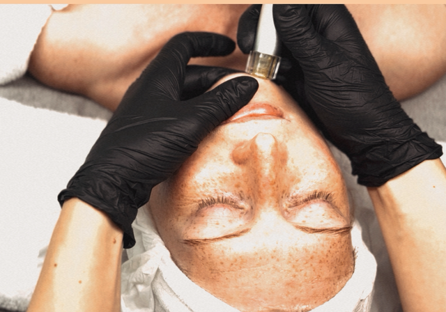 Hydra Glow Treatment (Microneedling)