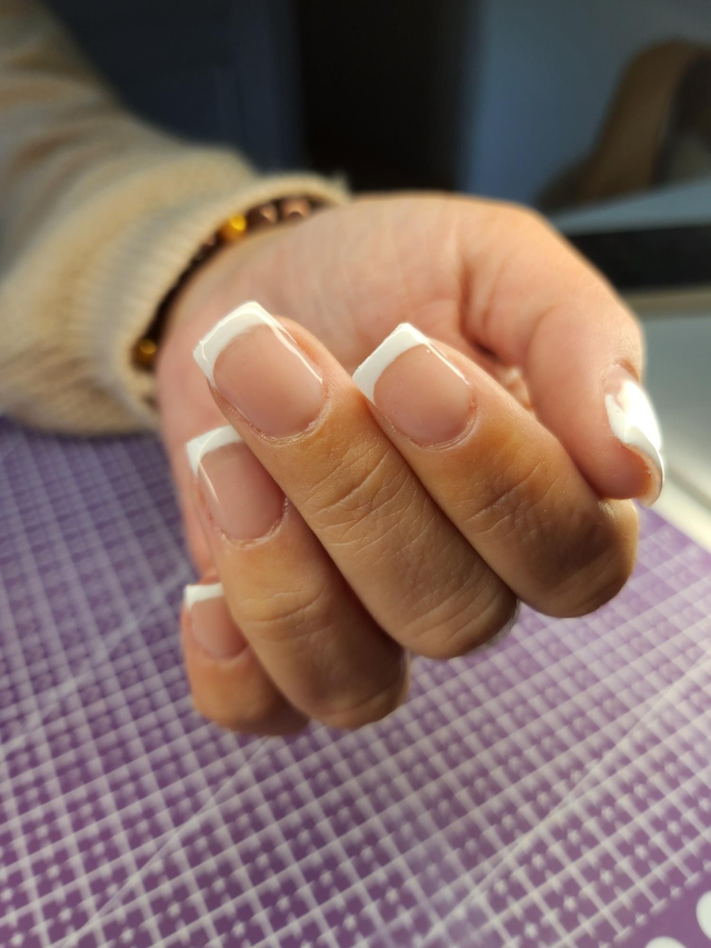 PRESTATION : Pose capsules américaines acompte 