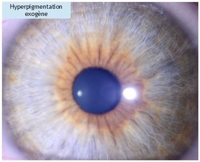 Iridologie - les bases - Solde