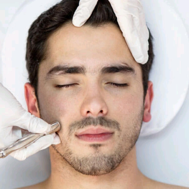 For Him Microdermabrasion Facial