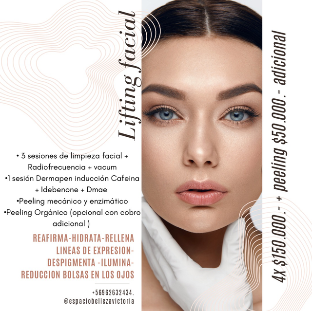 Lifting facial no invasivo