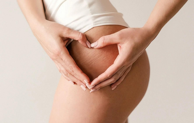 Vergetures sans pigments - Stretch marks without pigment