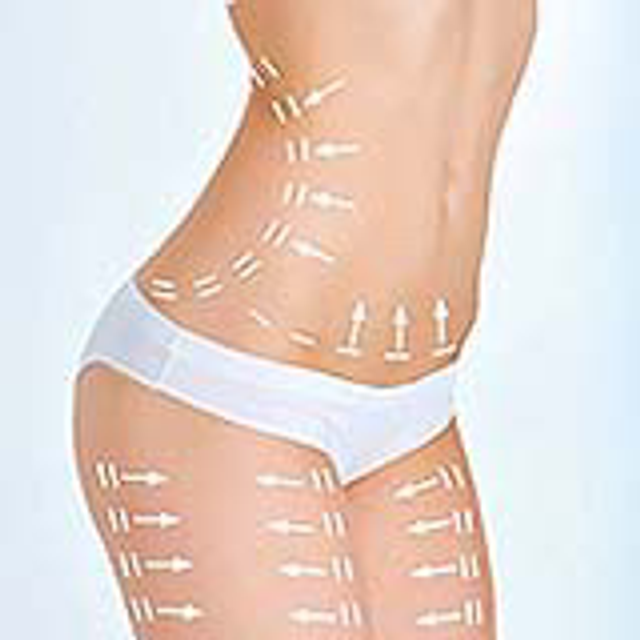 Aqualyx fat dissolve 