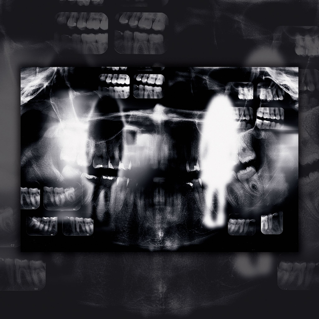 "Sisos" Liriz, 2024 | Reprodução print fine art 30 x 20 cm