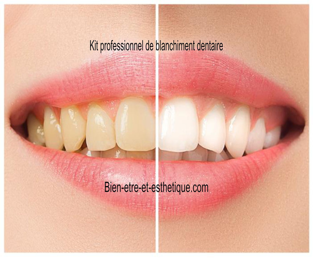 Produit sélectionné / Kit de blanchiment des dents  