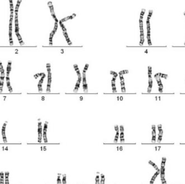 Estudio de cariotipo (hombre y mujer)
