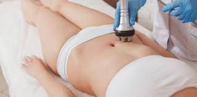 BONO 4 SESIONES RADIOFRECUENCIA