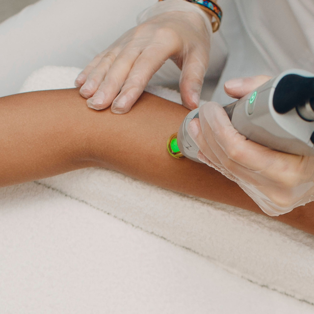 Laser Braccia e mano