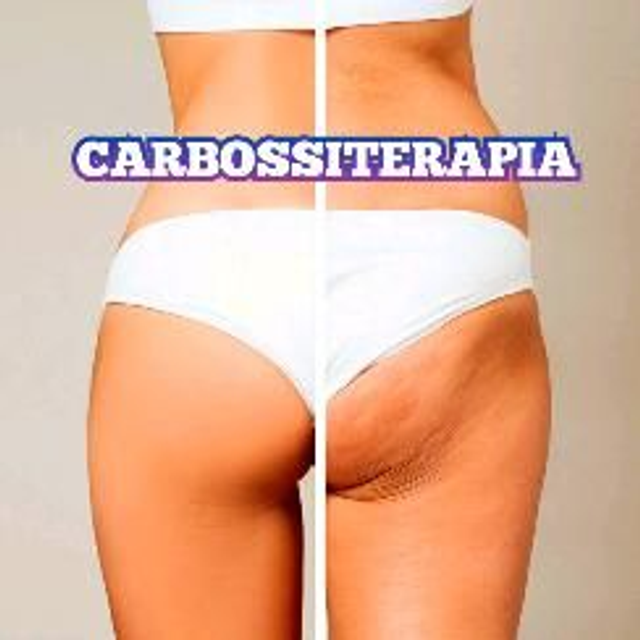 Carbossiterapia