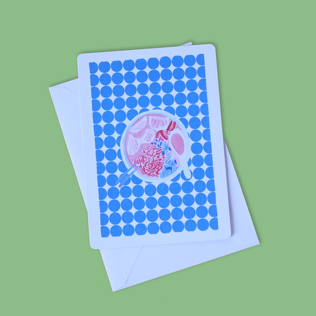 Carte postale 10x15 :: Nouilles