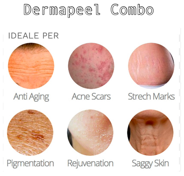 MICRONEEDLING rigenerante anti age