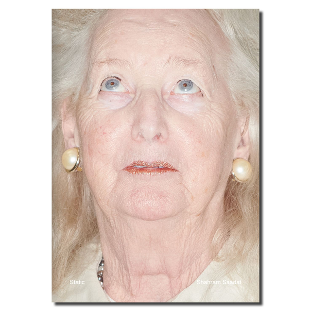 Static - Shahram Saadat