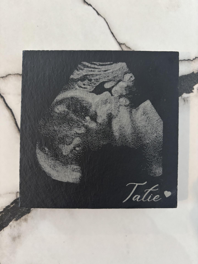 Echographie gravé sur un dessous de verre en ardoise 10 x 10 cm pour tatie