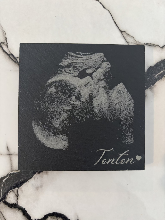 Echographie gravé sur un dessous de verre en ardoise 10 x 10 cm pour tonton