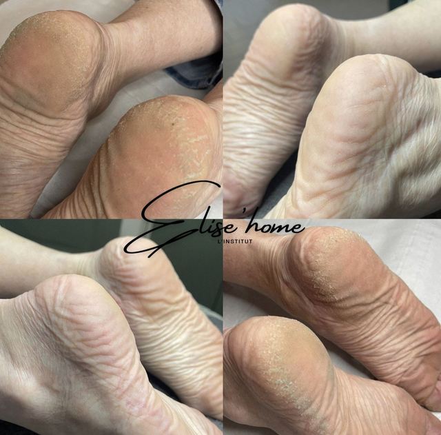 Ampoule hydratation acide hyaluronique ou cure 7 jours