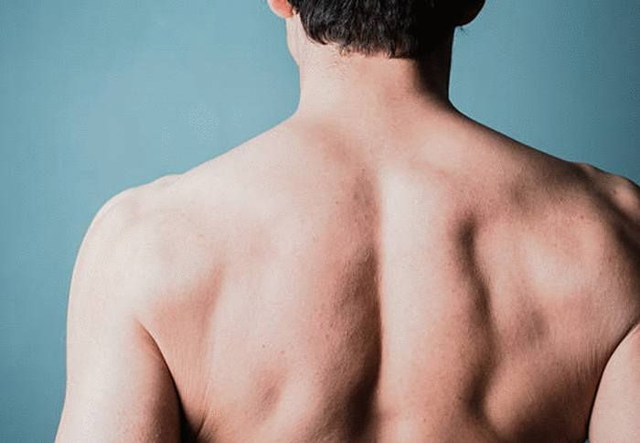 Soin Dos Purifiant anti boutons +