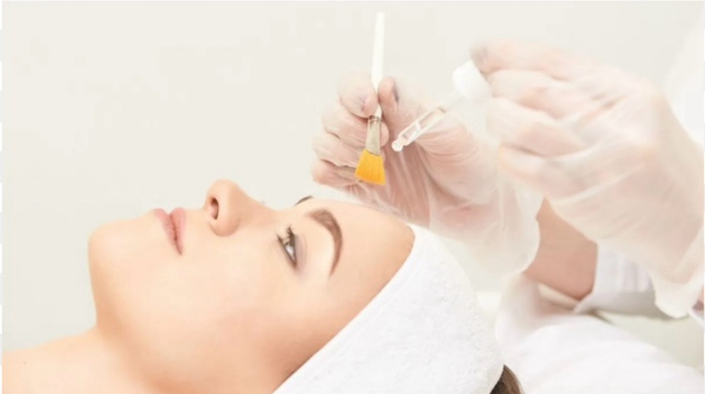 PEELING acido mandelico 