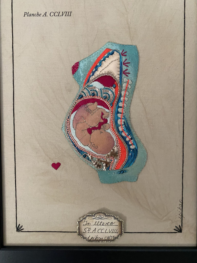 Planche anatomique grossesse bleu et rose fluo