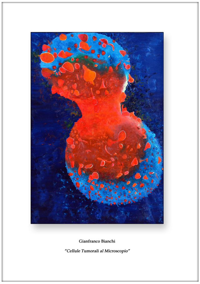 Litografia "Cellule Tumorali al Microscopio"