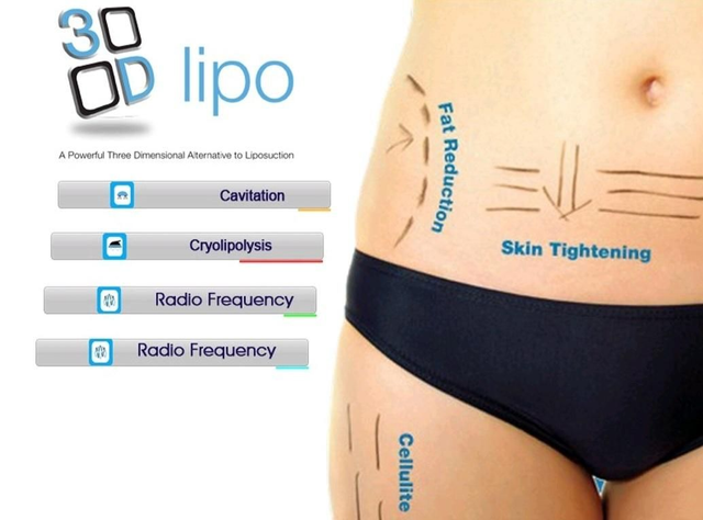 (RF) Cavitation + Skin Tightening