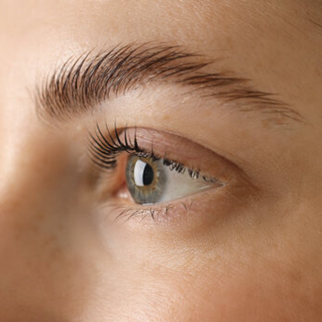 Formation browlift 