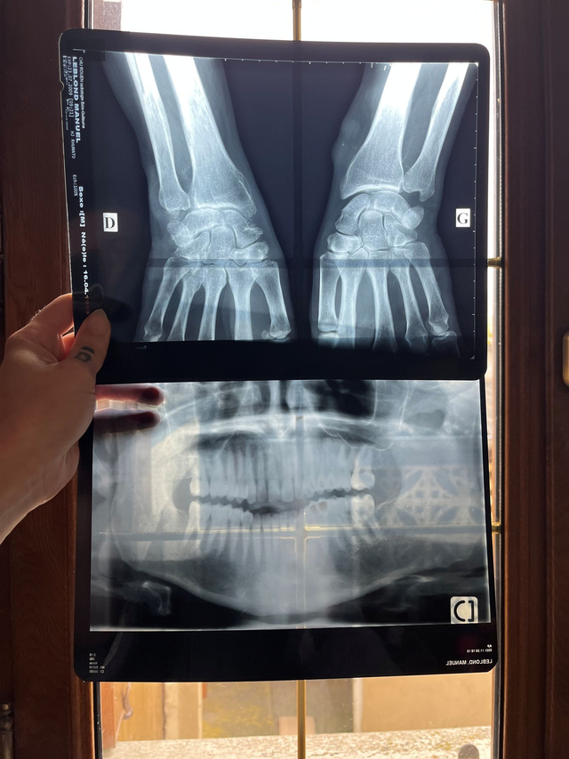 Radiographie médicale - X-Ray