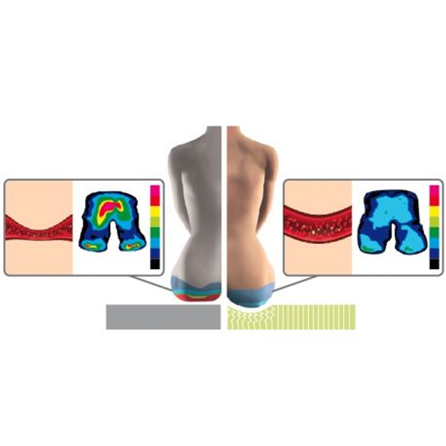 Coussin d’assise ergonomique Balance Seat – Confort & posture