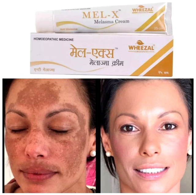 Mel X Melasma Cream 25 G