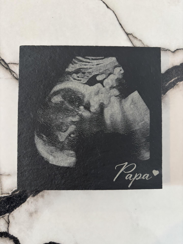 Echographie gravé sur un dessous de verre en ardoise 10 x 10 cm pour papa