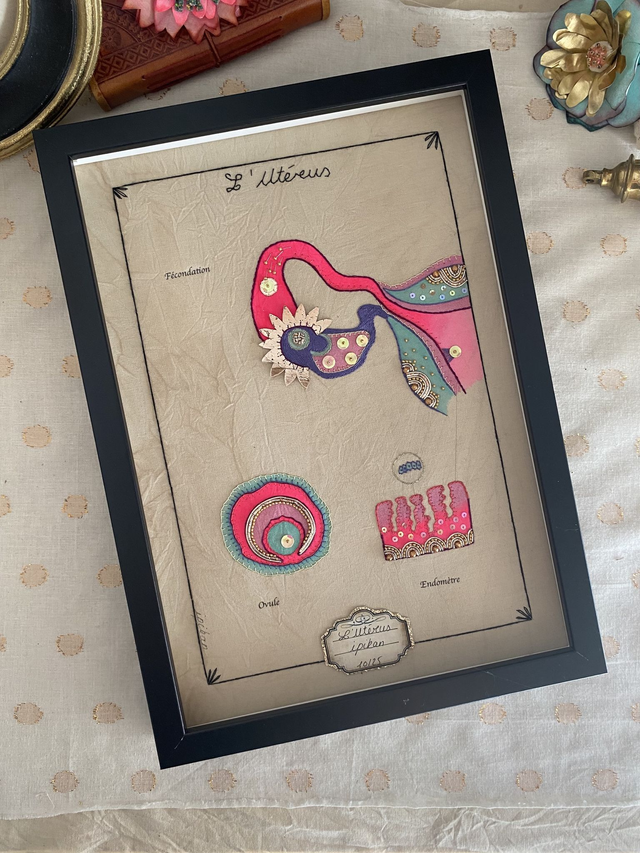 Planche anatomique utérus rose fluo