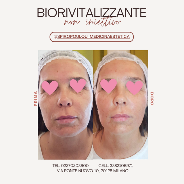 Biorivitalizzante non iniettivo