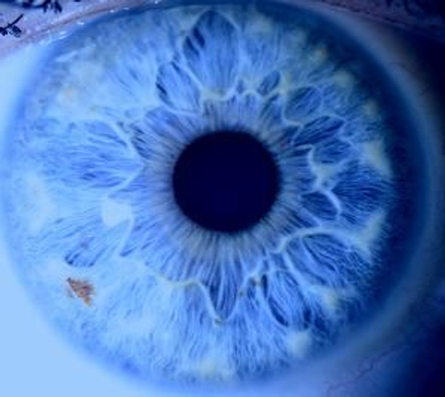  Iridologie les bases à distance - Solde