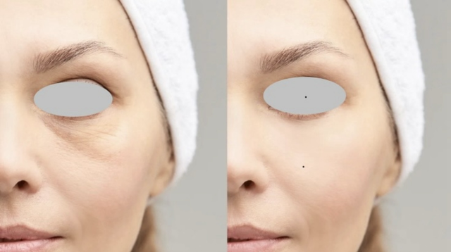 DERMA EYE - trattamento occhiaie e borse